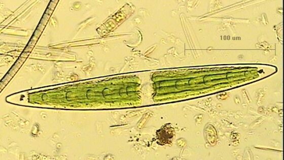 Closterium algae magnified 20x under a microscope.
