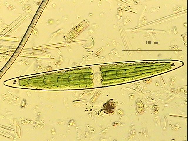 Closterium algae magnified 20x under a microscope.
