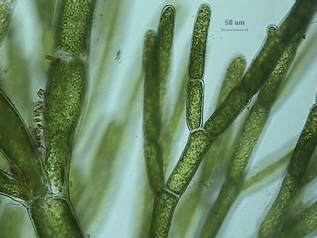 Cladophora algae magnified 10x.