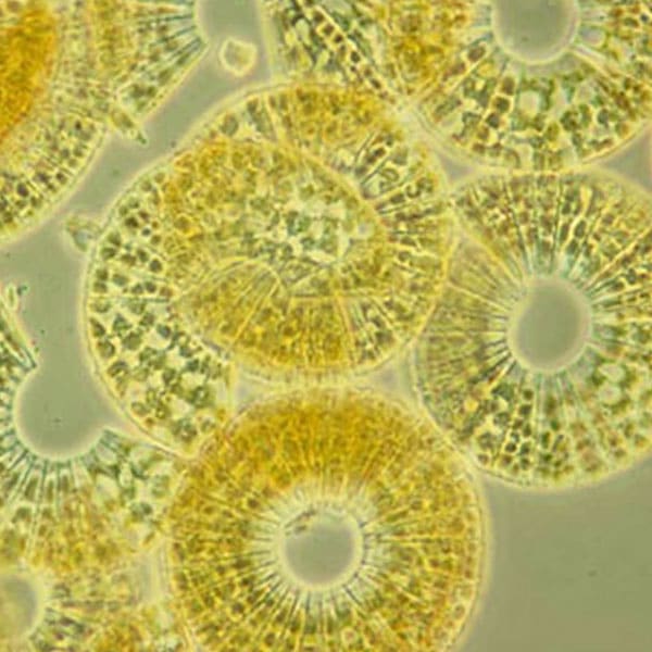 Meridian circulare diatoms seen under a microscope.